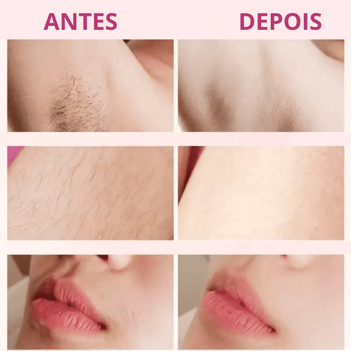 Depilador 2 em 1 FastShaver [DEPILAÇÃO COMPLETA EM SEGUNDOS] + BRINDES