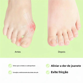 Corretor de Joanete em Silicone – Alinhador de Dedo
