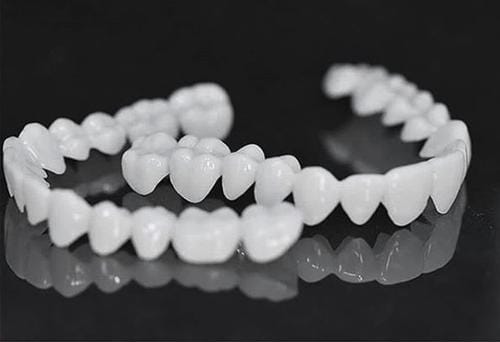 Lente de Contato Dental Removível Inferior e Superior