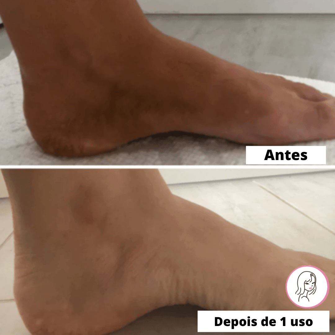 Luvas Esfoliantes de Banho SkinSoft